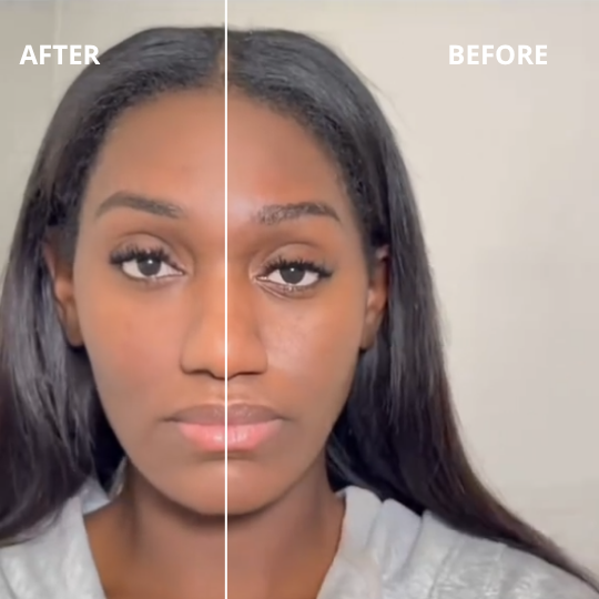 AuraLymph™ - Lymphatic Contour Face Brush