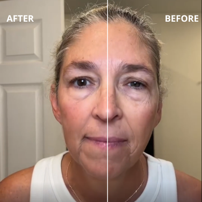 AuraLymph™ - Lymphatic Contour Face Brush