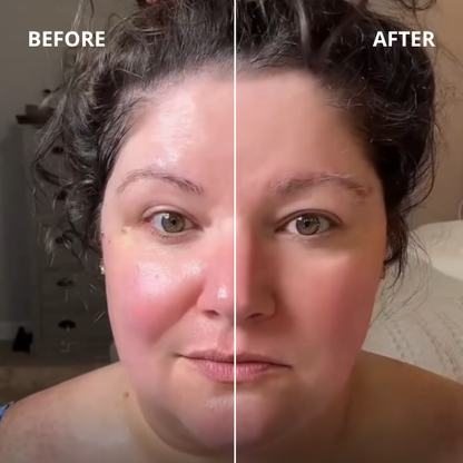 AuraLymph™ - Lymphatic Contour Face Brush