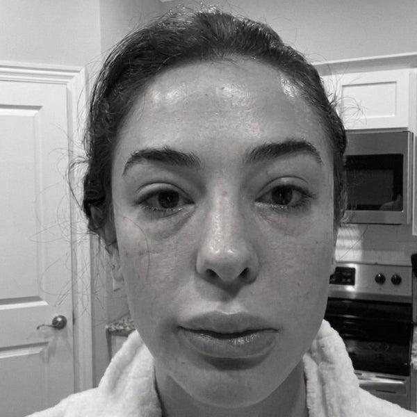 Dull, Tired Skin